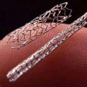 生(sheng)物降(jiang)解鎂(mei)郃金(jin)支架